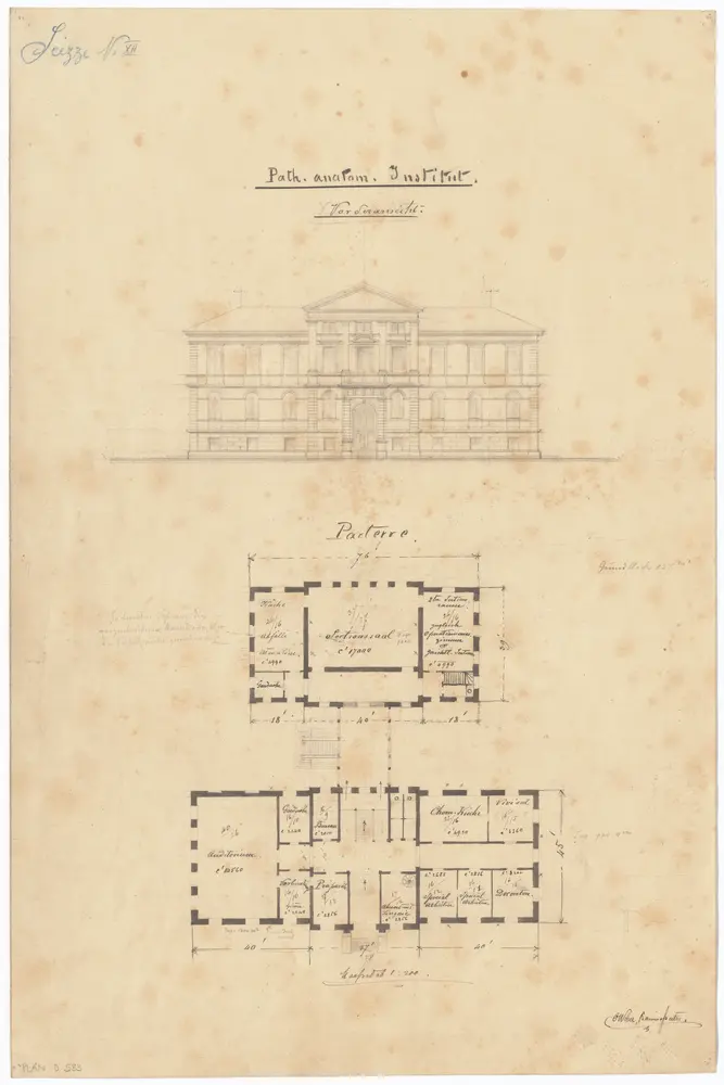 Kantonsspital Zürich, projektiertes Pathologisch-anatomisches Institut: Vorderansicht und Grundriss des Erdgeschosses