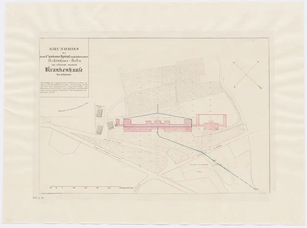 Fluntern: Zum Kantonsspital Zürich gehörender Schönhaus-Hof, mit projektiertem Krankenhaus; Grundriss