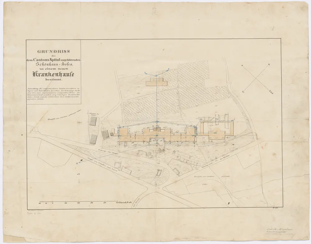 Fluntern: Zum Kantonsspital Zürich gehörender Schönhaus-Hof, mit projektiertem Krankenhaus; Grundriss
